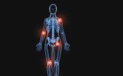 images/exams/Cintilografia Óssea.webp