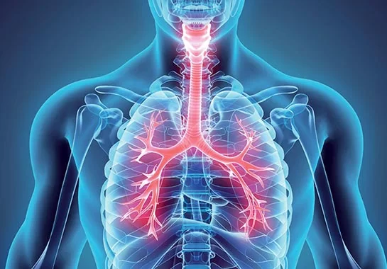 images/exams/Cintilografia Pulmonar de Inalação e Perfusão.webp