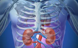 images/exams/Cintilografia Renal e com Prova de Captopril.webp