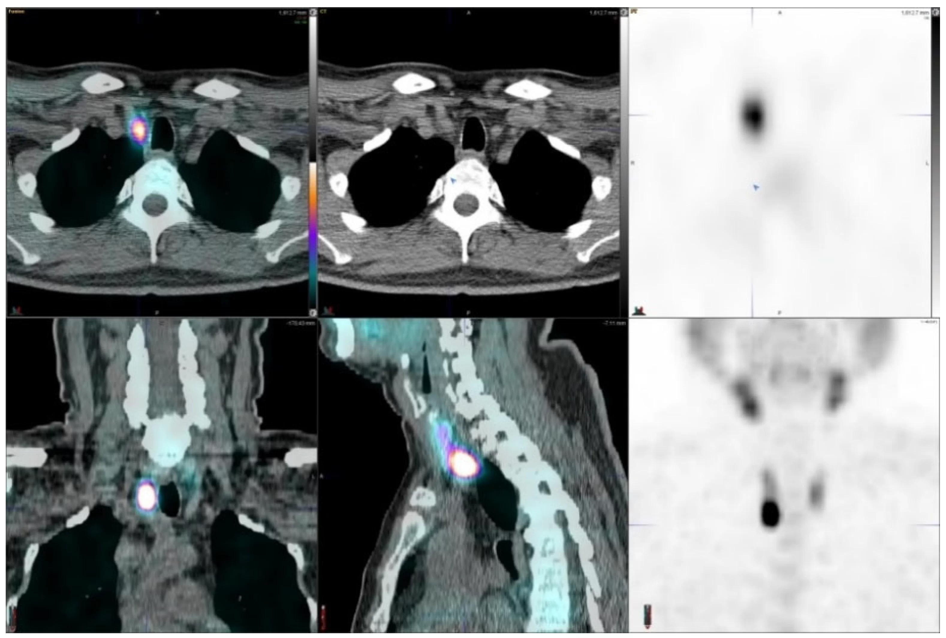 images/exams/Cintilografia da Paratireoide.webp
