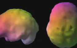 images/exams/Cintilografia de Perfusão Cerebral.webp