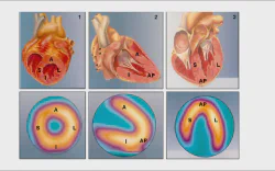 images/exams/Cintilografia de Perfusão Miocárdica.webp