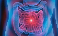 images/exams/Cintilografia para Pesquisa de Diverticulo de Meckel.webp