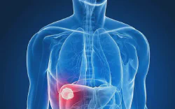 images/exams/Cintilografia para Pesquisa de Hemangioma Hepático.webp