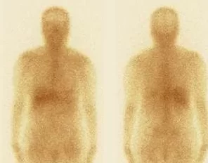 images/exams/Pesquisa de Corpo Inteiro com Gálio-67.webp
