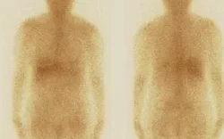 images/exams/Pesquisa de Corpo Inteiro com Gálio-67.webp