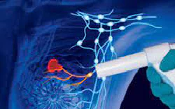 images/exams/Pesquisa de Linfonodo Sentinela.jpeg