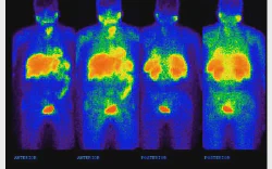 images/exams/Pesquisa de corpo inteiro com Sestamibi.webp