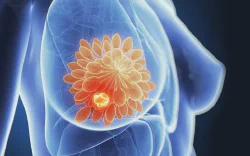 images/exams/ROLL e SNOLL.webp