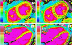 images/exams/Ressonância Magnética Cardíaca.webp