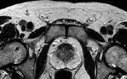 images/exams/Ressonância Magnética da Próstata.jpg