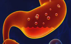 images/exams/Cintilografia para Estudo do Esvaziamento Gastroesofágico de Alimentos Sólidos.webp