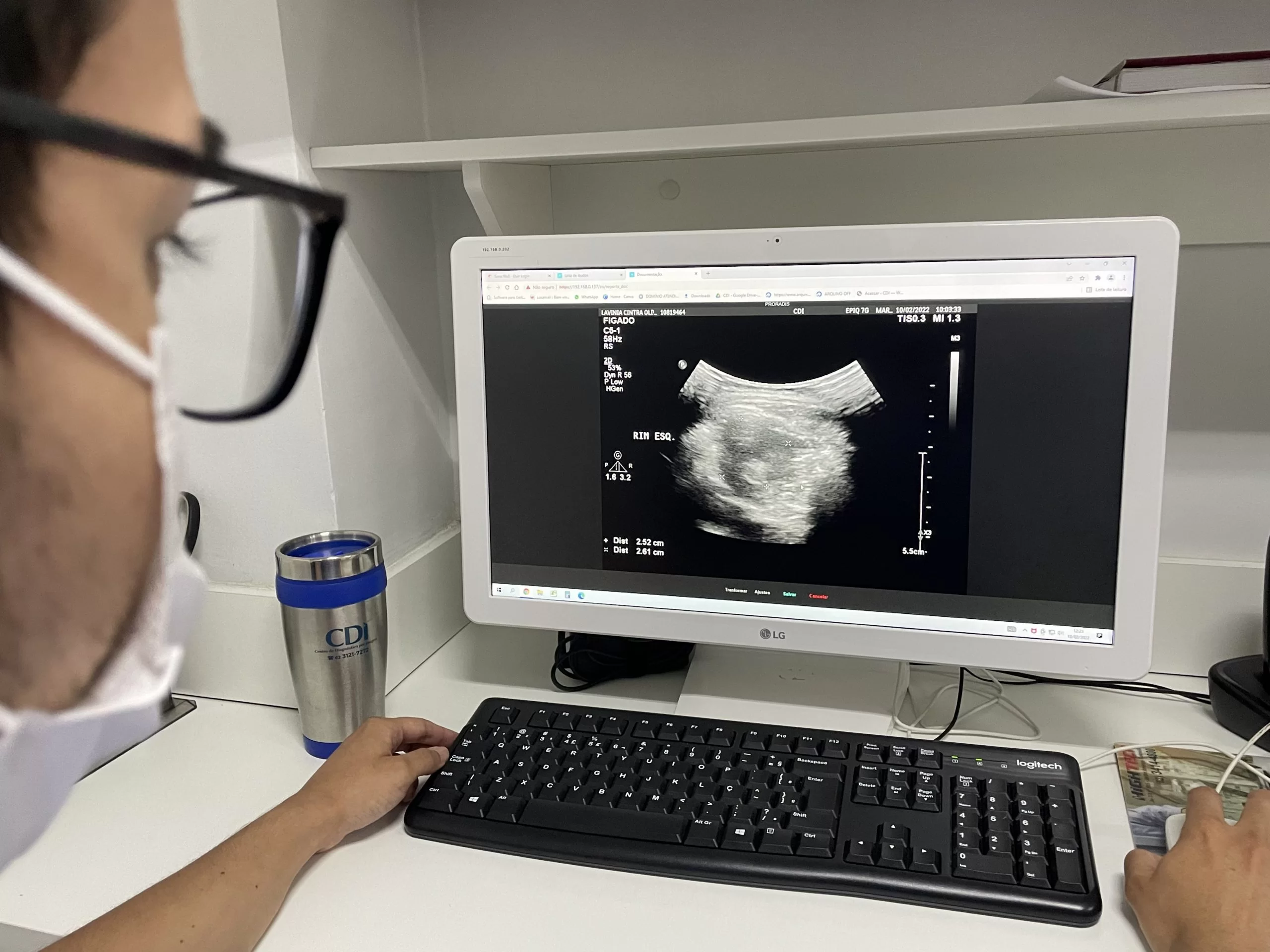Ultrassonografia De Vias Urinárias Ou Aparelho Urinário Feminino Masculino